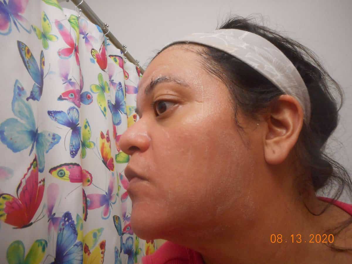 Derma-E Deep Pore Cleansing Wash applied to my face side view.