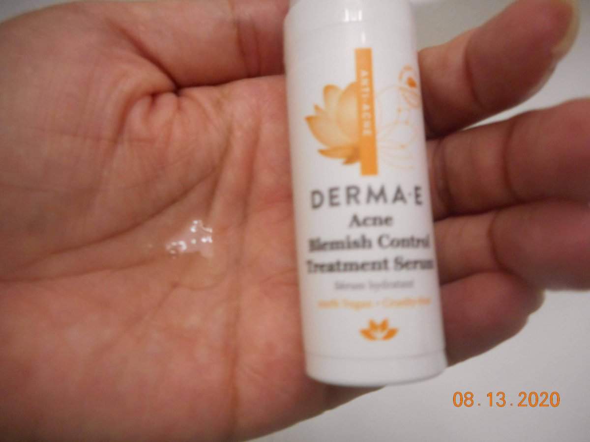 Derma-E Acne Blemish Control Treatment Serum. Serum in my hand with bottle.