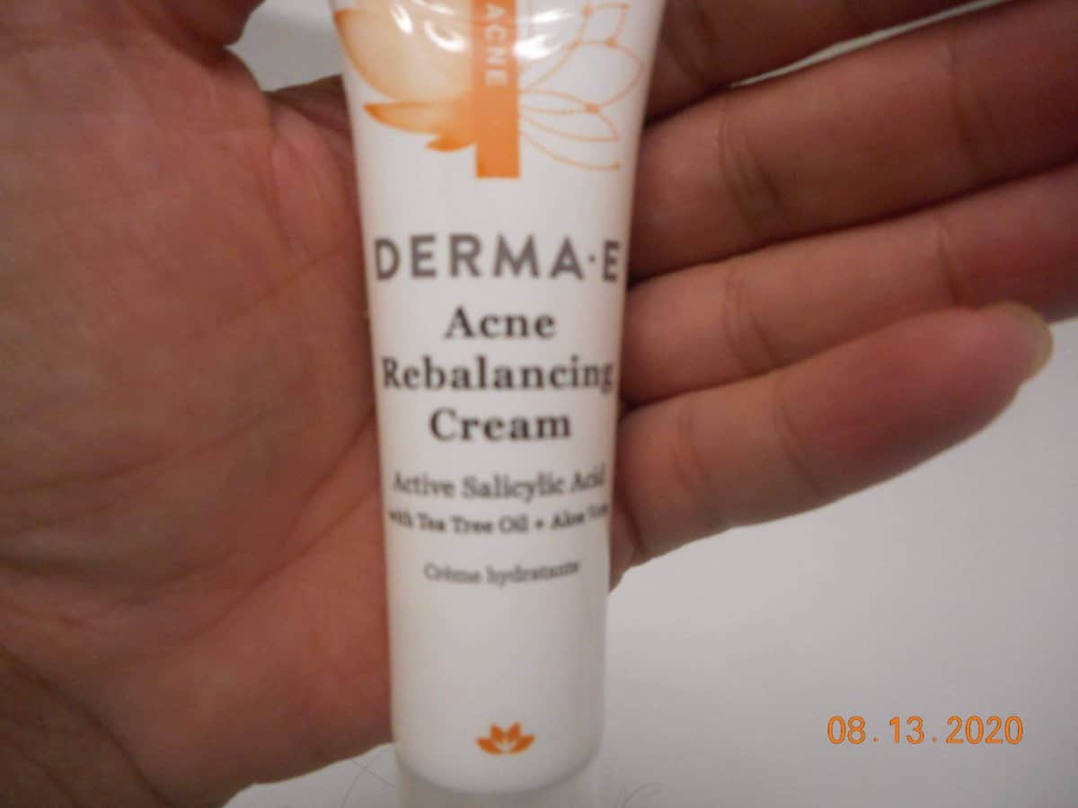 Acne Rebalancing Cream tube in my hand.