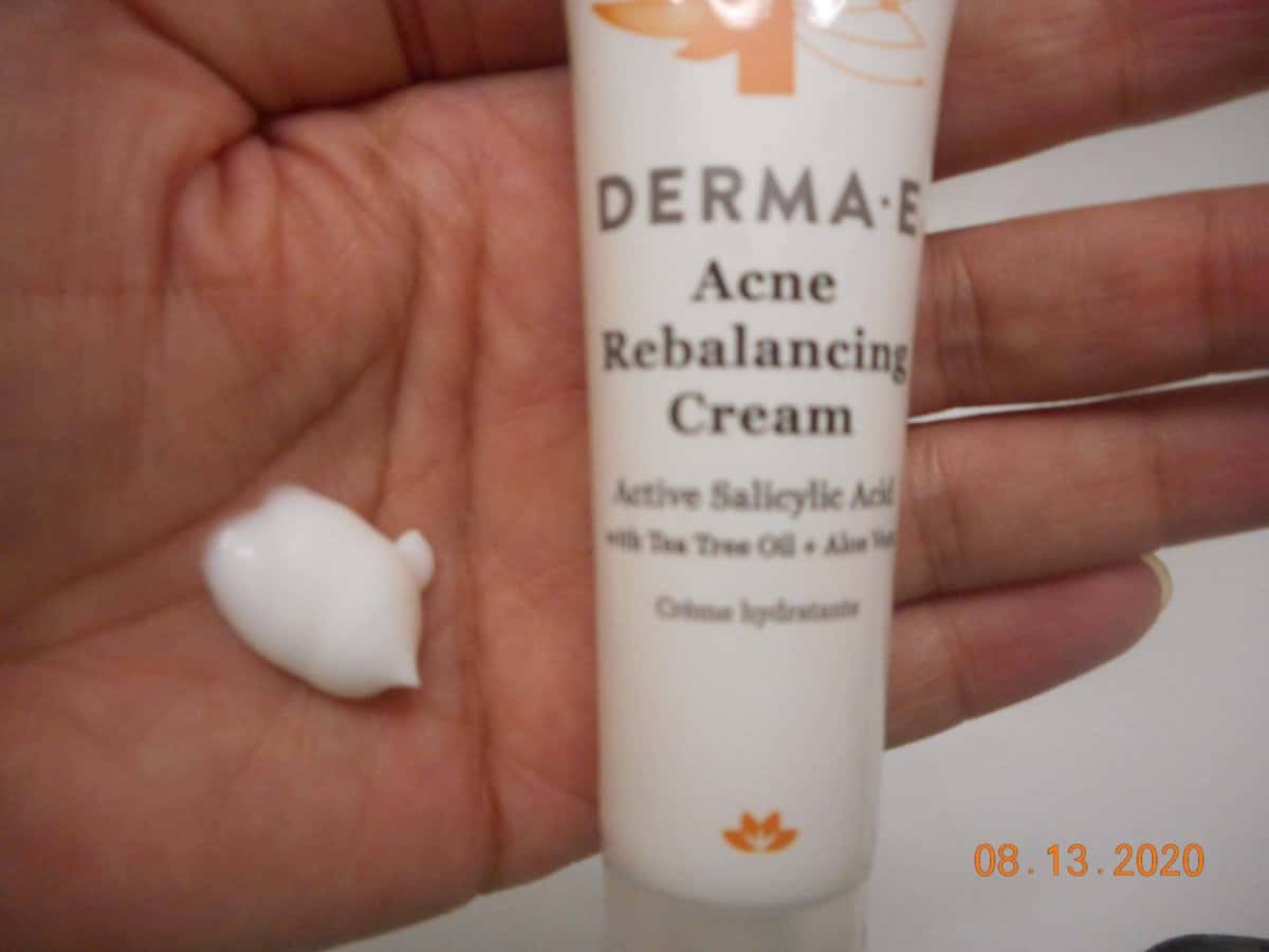 Acne Rebalancing Cream tube with cream in my hand.