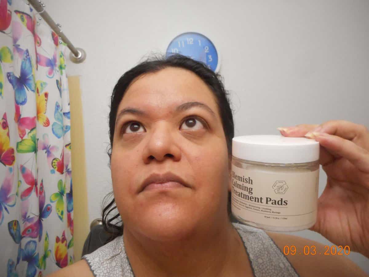 my face after applying BEAUTREE Blemish Calming Treatment Pads.