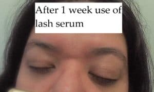 1 week after using Lancome lash serum.